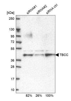 Western Blot: TBCC Antibody [NBP1-85679]