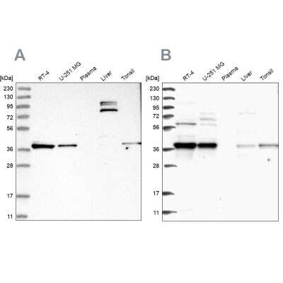 Western Blot: TBCC Antibody [NBP1-85679]