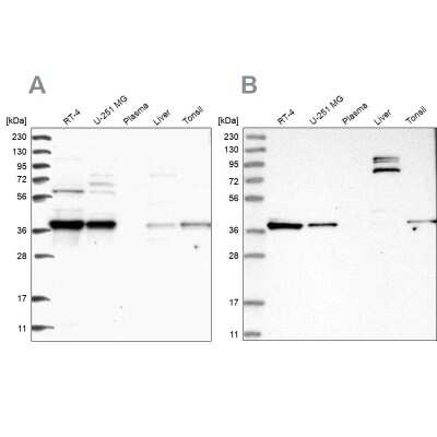 Western Blot: TBCC Antibody [NBP2-38233]