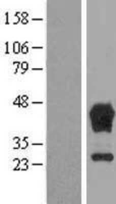 Western Blot: TBCC Overexpression Lysate [NBL1-16736]