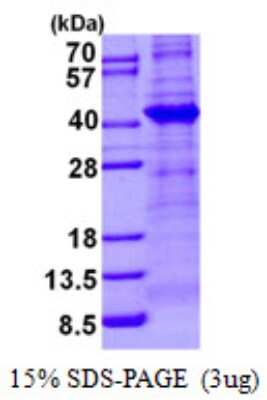 SDS-PAGE: Recombinant Human TBCC His Protein [NBP2-22897]