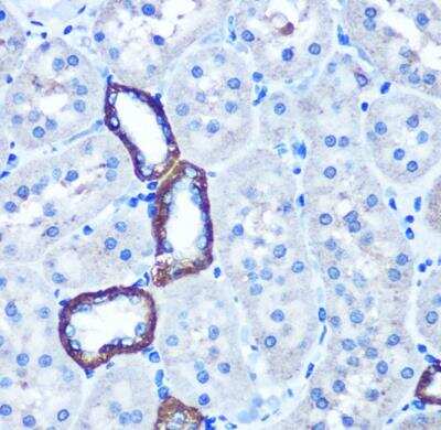 Immunohistochemistry-Paraffin: TBCCD1 Antibody - Azide and BSA Free [NBP2-94513]
