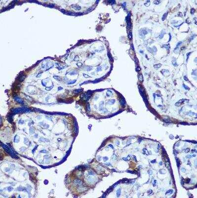 Immunohistochemistry-Paraffin: TBCCD1 Antibody - Azide and BSA Free [NBP2-94513]