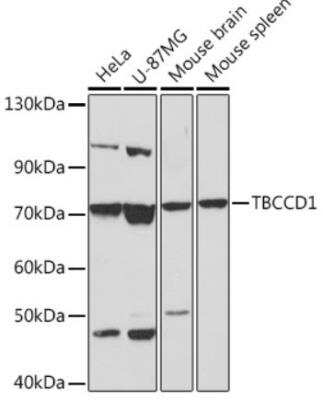 Western Blot: TBCCD1 AntibodyAzide and BSA Free [NBP2-94513]