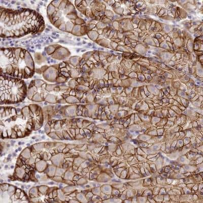 Immunohistochemistry-Paraffin: TBCD Antibody [NBP1-92480]