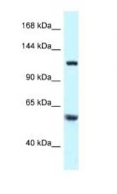 Western Blot: TBCD Antibody [NBP1-79913]