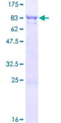 SDS-PAGE: Recombinant Human TBCD GST (N-Term) Protein [H00006904-P01]