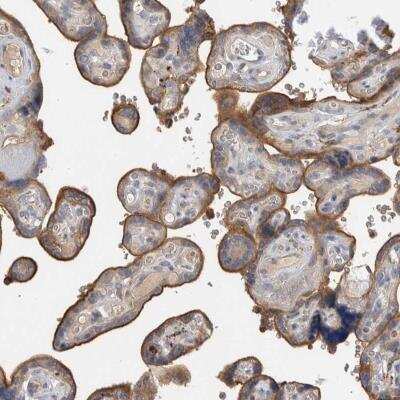 Immunohistochemistry: TBCE Antibody [NBP1-81713]