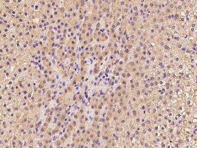 Immunohistochemistry-Paraffin: TBCE Antibody [NBP3-06359]