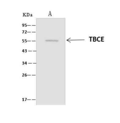 Immunoprecipitation: TBCE Antibody [NBP3-06359]