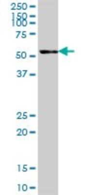 Western Blot: TBCE Antibody [H00006905-B01P]