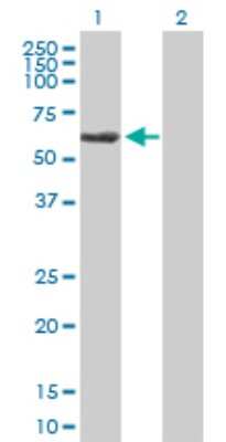 Western Blot: TBCE Antibody [H00006905-B01P]