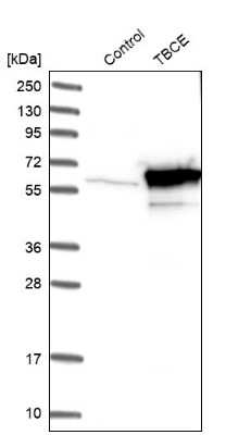 Western Blot: TBCE Antibody [NBP1-81711]