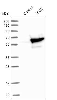 Western Blot: TBCE Antibody [NBP1-81713]