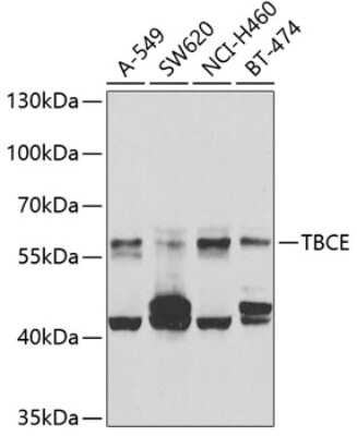 Western Blot: TBCE AntibodyBSA Free [NBP2-93127]