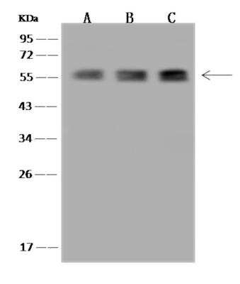 Western Blot: TBCE Antibody [NBP3-06359]