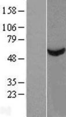 Western Blot: TBCE Overexpression Lysate [NBP2-09265]