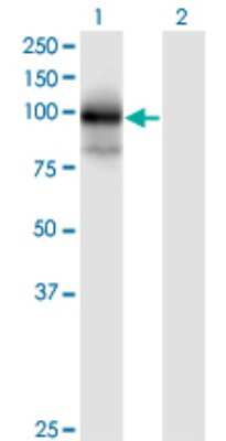 Western Blot: TBCK Antibody (7A7) [H00093627-M01]