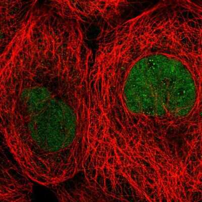 Immunocytochemistry/ Immunofluorescence: TBCK Antibody [NBP2-58711]