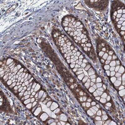 Immunohistochemistry-Paraffin: TBCK Antibody [NBP1-83166]