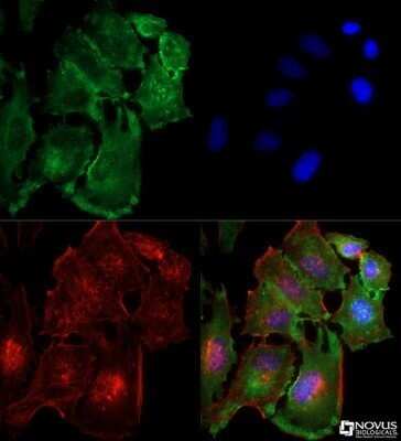 Immunocytochemistry/ Immunofluorescence: TBK1 Antibody (108A429) - Azide and BSA Free [NBP2-33243]