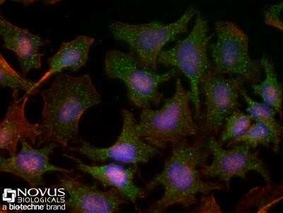 Immunocytochemistry/ Immunofluorescence: TBK1 Antibody (108A429) - Azide and BSA Free [NBP2-33243]