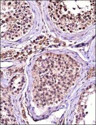 Immunohistochemistry-Paraffin: TBK1 Antibody (108A429) - Azide and BSA Free [NBP2-33243]