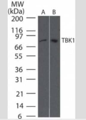 Western Blot: TBK1 Antibody (108A429)Azide and BSA Free [NBP2-33243]