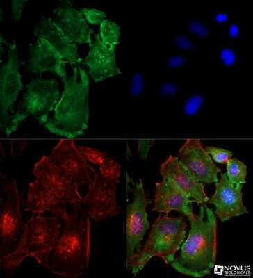 Immunocytochemistry/ Immunofluorescence: TBK1 Antibody (108A429) - BSA Free [NB100-56705]