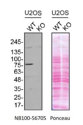 Knockout Validated: TBK1 Antibody (108A429) - BSA Free [NB100-56705]