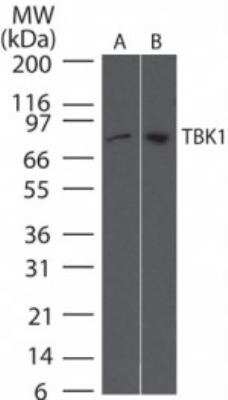 Western Blot: TBK1 Antibody (108A429)BSA Free [NB100-56705]