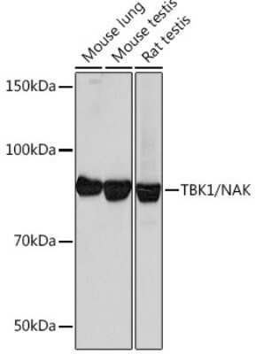 Western Blot: TBK1 Antibody (4G6C7) [NBP3-16189]