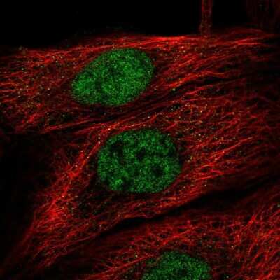 Immunocytochemistry/ Immunofluorescence: TBK1 Antibody [NBP2-13416]