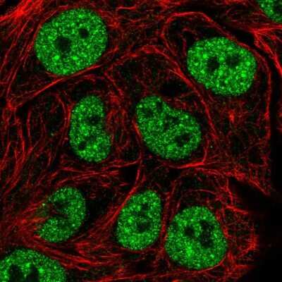 Immunocytochemistry/ Immunofluorescence: TBK1 Antibody [NBP2-55777]