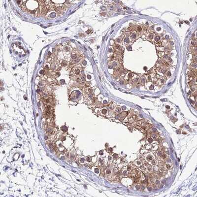Immunohistochemistry-Paraffin: TBK1 Antibody [NBP2-13416]