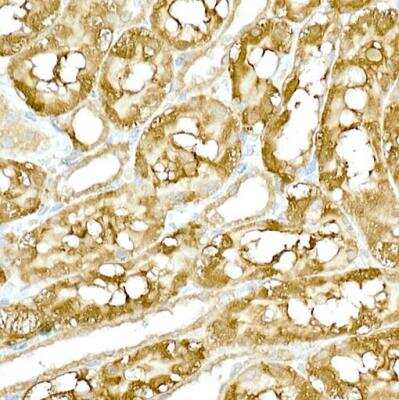 Immunohistochemistry-Paraffin: TBK1 Antibody - Azide and BSA Free [NBP2-93921]