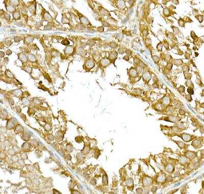 Immunohistochemistry-Paraffin: TBK1 Antibody - Azide and BSA Free [NBP2-93921]