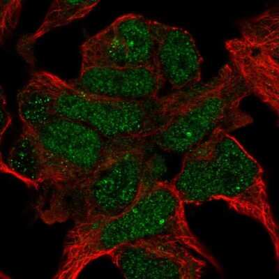 Immunocytochemistry/ Immunofluorescence: TBKBP1 Antibody [NBP2-37989]