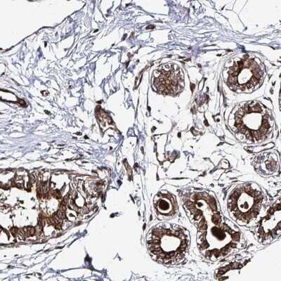 Immunohistochemistry: TBKBP1 Antibody [NBP2-37989]