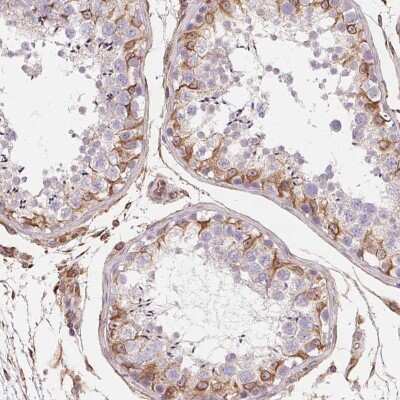 Immunohistochemistry-Paraffin: TBKBP1 Antibody [NBP2-38057]