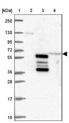 Western Blot: TBKBP1 Antibody [NBP2-38057]