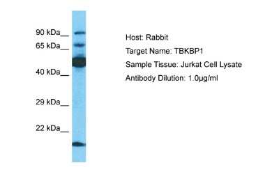 Western Blot: TBKBP1 Antibody [NBP2-88420]