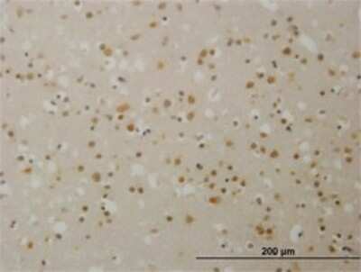 Immunohistochemistry-Paraffin: TBL1 Antibody (2B6) [H00006907-M07]