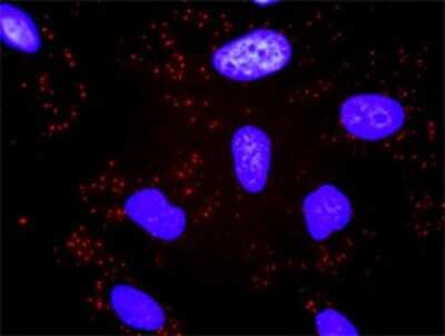 Proximity Ligation Assay: TBL1 Antibody (2B6) [H00006907-M07]