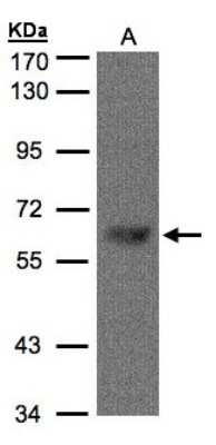 Western Blot: TBL1 Antibody [NBP1-31058]