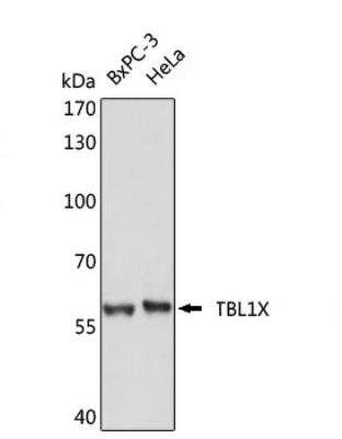 Western Blot: TBL1 Antibody [NBP2-95262]