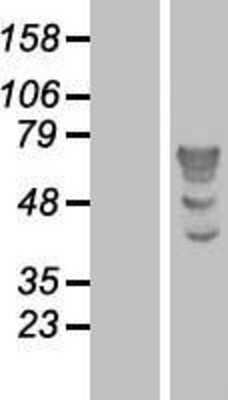 Western Blot: TBL1 Overexpression Lysate [NBP2-10452]