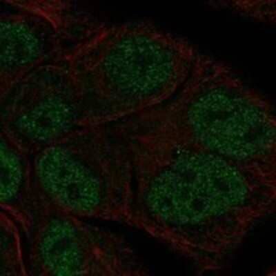 Immunocytochemistry/ Immunofluorescence: TBL1Y Antibody [NBP3-17546]