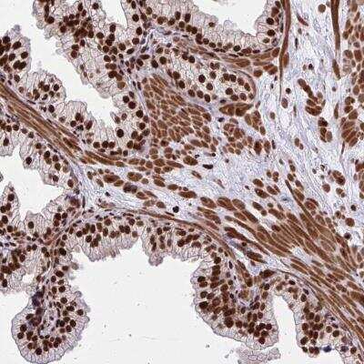 Immunohistochemistry-Paraffin: TBL1Y Antibody [NBP2-32513]