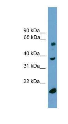 Western Blot: TBL1Y Antibody [NBP1-79459]